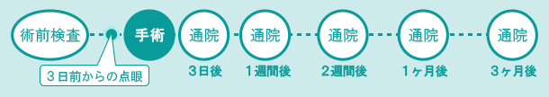 白内障手術の日程